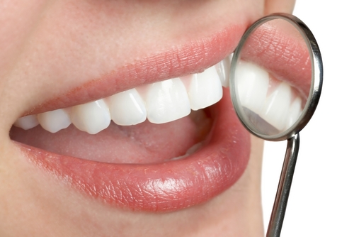 Dental Insurance: Is It Worth The Cost?