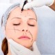 5 Steps For Finding A Cosmetic Surgeon