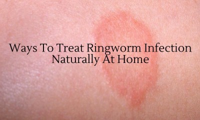 Ways To Treat Ringworm Infection Naturally At Home