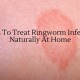 Ways To Treat Ringworm Infection Naturally At Home