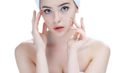 Acne Products For Sensitive Skin: A Solution For All