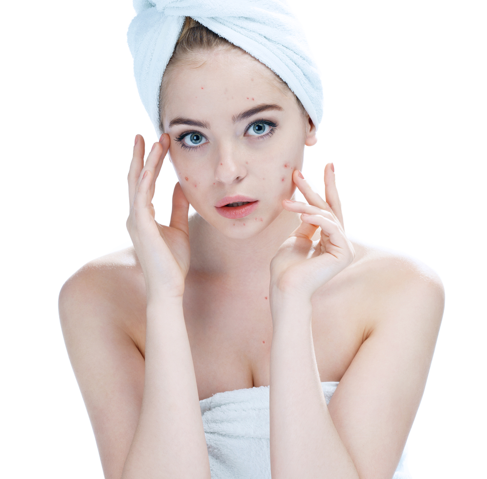 Acne Products For Sensitive Skin: A Solution For All