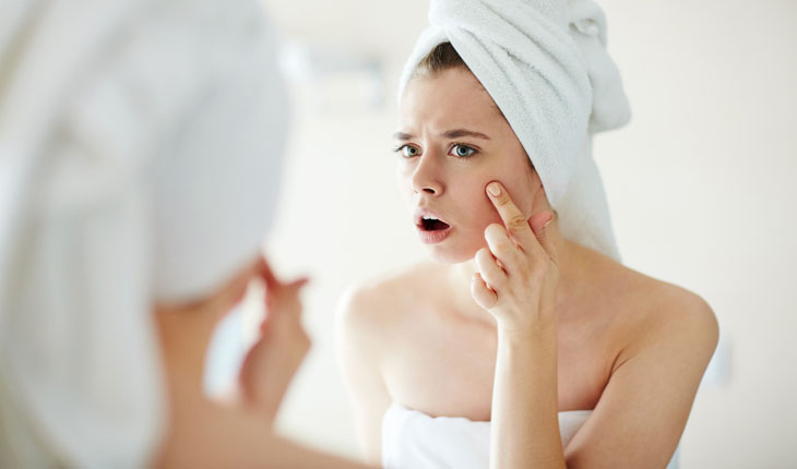 how-to-deal-with-your-acne-prone-skin