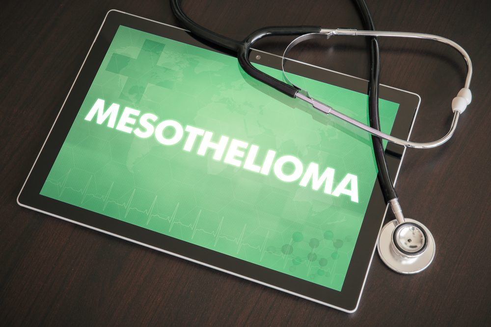 The Difference Between Asbestos Lung Cancer and Mesothelioma