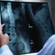 Tips For A Speedy Recovery from A Spine Surgery