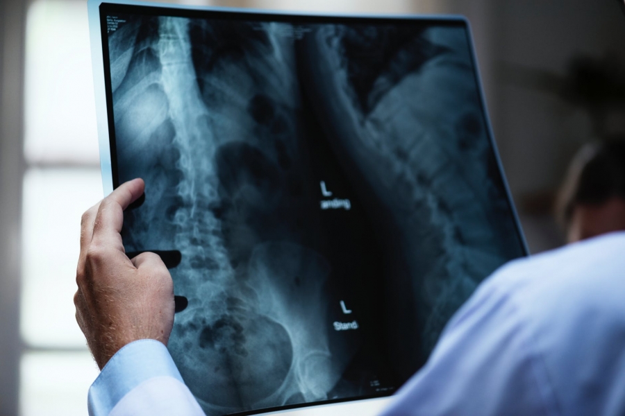 Tips For A Speedy Recovery from A Spine Surgery