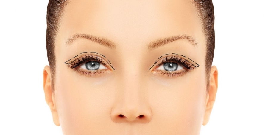 Reasons Why Men and Women Undergo Eyelid Surgery